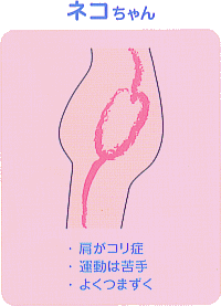 ・肩がコリ症 ・運動は苦手 ・よくつまずく